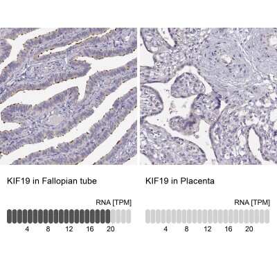 Immunohistochemistry-Paraffin: KIF19 Antibody [NBP2-57895]