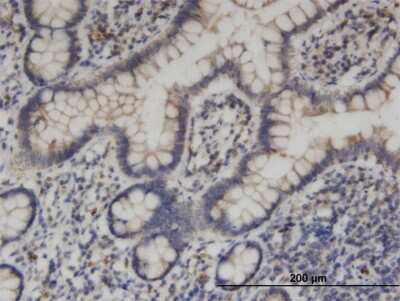Immunohistochemistry-Paraffin: KIF1C Antibody (1F12) [H00010749-M06]
