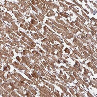 Immunohistochemistry-Paraffin: KIF1C Antibody [NBP2-48824]