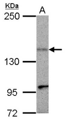 Western Blot: KIF1C Antibody [NBP2-17051]