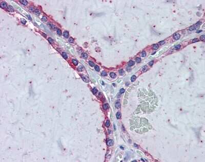 Immunohistochemistry: KIF20A Antibody [NBP2-87689]