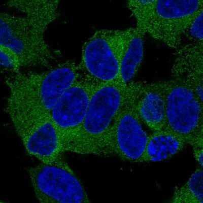 Immunocytochemistry/ Immunofluorescence: KIF21A Antibody [NBP2-37969]