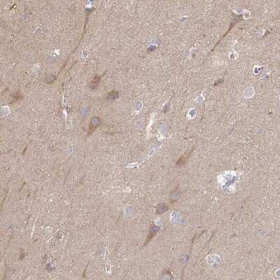 Immunohistochemistry-Paraffin: KIF21A Antibody [NBP2-37969]