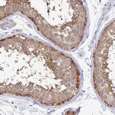Immunohistochemistry-Paraffin: KIF21A Antibody [NBP2-37969]