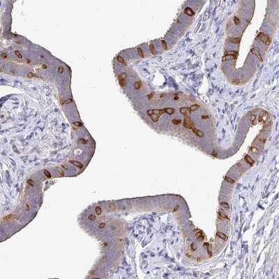 Immunohistochemistry-Paraffin: KIF21A Antibody [NBP2-37969]