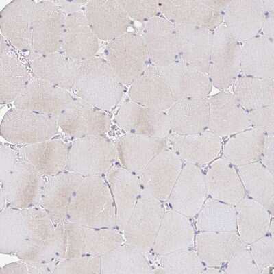 Immunohistochemistry-Paraffin: KIF21A Antibody [NBP2-37969]