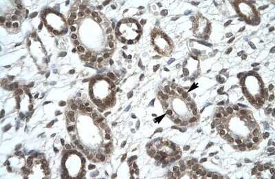 Immunohistochemistry-Paraffin: KIF25 Antibody [NBP1-80034]