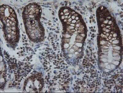 Immunohistochemistry: KIF25 Antibody (OTI2F4) - Azide and BSA Free [NBP2-71077]