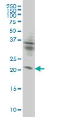 Western Blot: KIF26A Antibody (3C10) [H00026153-M01]