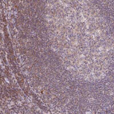 Immunohistochemistry: KIF26A Antibody [NBP2-38891]
