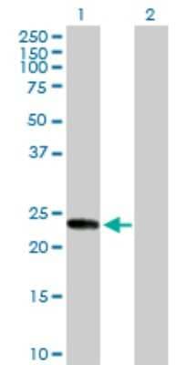 Western Blot: KIF26A Antibody [H00026153-D01P]