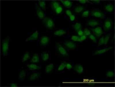 Immunocytochemistry/ Immunofluorescence: KIF2C Antibody (1G2) [H00011004-M01]