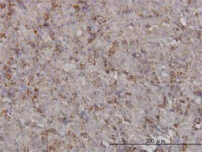 Immunohistochemistry-Paraffin: KIF2C Antibody (1G2) [H00011004-M01]