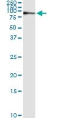 Immunoprecipitation: KIF2C Antibody (1G2) [H00011004-M01]