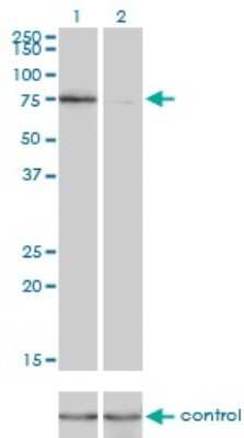 Western Blot: KIF2C Antibody (1G2) [H00011004-M01]