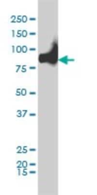 Western Blot: KIF2C Antibody (1G2) [H00011004-M01]