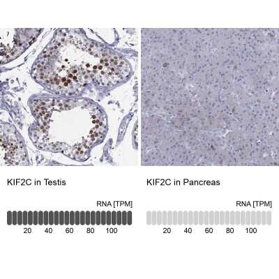 Immunocytochemistry/ Immunofluorescence: KIF2C Antibody [NBP3-17038]