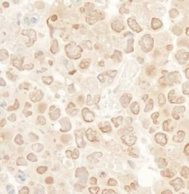 Immunohistochemistry-Paraffin: KIF2C Antibody [NB110-40688]