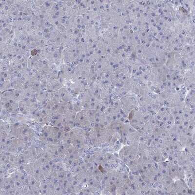 Immunohistochemistry-Paraffin: KIF2C Antibody [NBP3-17038]