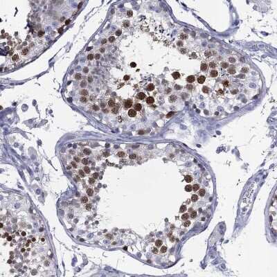 Immunohistochemistry-Paraffin: KIF2C Antibody [NBP3-17038]