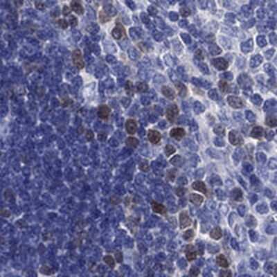 Immunohistochemistry-Paraffin: KIF2C Antibody [NBP3-17038]