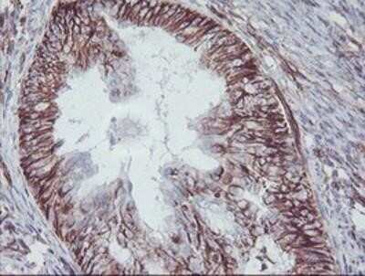 Immunohistochemistry: KIF2C Antibody (OTI1C5) - Azide and BSA Free [NBP2-71667]