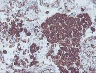 Immunohistochemistry: KIF2C Antibody (OTI1C5) - Azide and BSA Free [NBP2-71667]