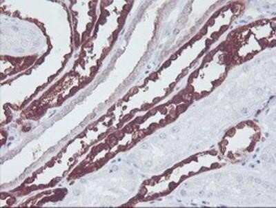 Immunohistochemistry: KIF2C Antibody (OTI1C5) - Azide and BSA Free [NBP2-71667]