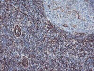Immunohistochemistry: KIF2C Antibody (OTI1C5) - Azide and BSA Free [NBP2-71667]