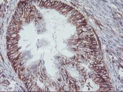 Immunohistochemistry-Paraffin: KIF2C Antibody (OTI1C5) [NBP2-01064]