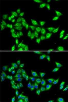 Immunocytochemistry/ Immunofluorescence: KIF3A Antibody - BSA Free [NBP3-05030]