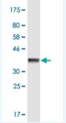 Western Blot: KIF3B Antibody (8H4) [H00009371-M01-100ug]