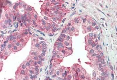 Immunohistochemistry-Paraffin: KIF6 Antibody [NBP1-44066]
