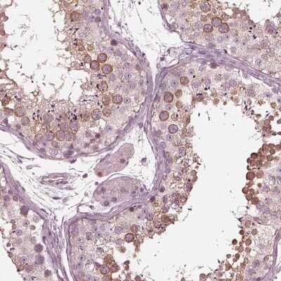 Immunohistochemistry-Paraffin: KIF6 Antibody [NBP1-86767]