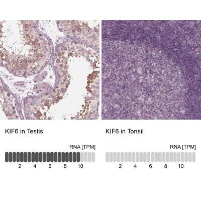Immunohistochemistry-Paraffin: KIF6 Antibody [NBP1-86767]
