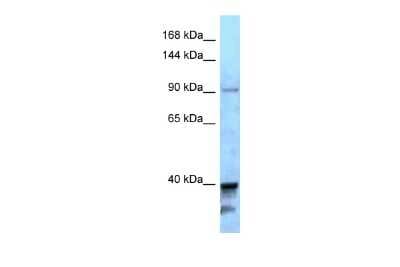 Western Blot: KIF7 Antibody [NBP2-85154]