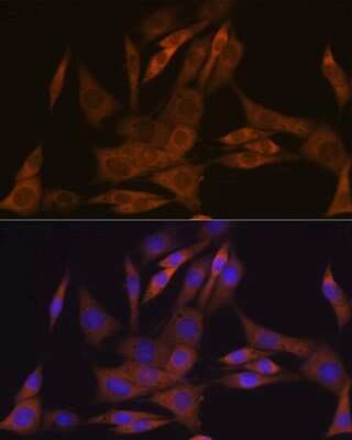 Immunocytochemistry/ Immunofluorescence: KIFAP3 Antibody (1S7J7) [NBP3-16592]