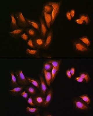 Immunocytochemistry/ Immunofluorescence: KIFAP3 Antibody - BSA Free [NBP3-04508]