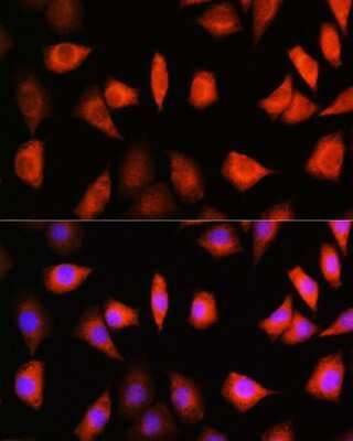 Immunocytochemistry/ Immunofluorescence: KIFAP3 Antibody - BSA Free [NBP3-04508]
