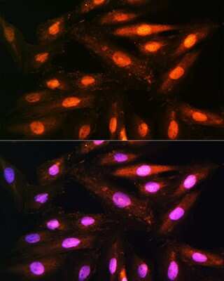 Immunocytochemistry/ Immunofluorescence: KIFAP3 Antibody - BSA Free [NBP3-04508]