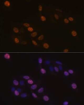 Immunocytochemistry/ Immunofluorescence: KIFC1 Antibody (10M10J4) [NBP3-15248]