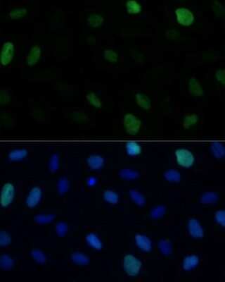 Immunocytochemistry/ Immunofluorescence: KIFC1 Antibody - Azide and BSA Free [NBP3-04585]