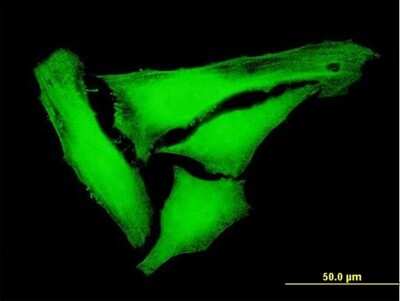 Immunocytochemistry/ Immunofluorescence: KIFC3 Antibody [H00003801-B01P]