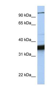 Western Blot: KIFC3 Antibody [NBP1-58178]