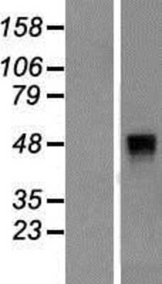 Western Blot: KIR2.3 Overexpression Lysate [NBP2-10515]