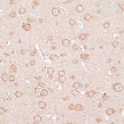 Immunohistochemistry-Paraffin: KIR2.3 Antibody - BSA Free [NBP3-03005]