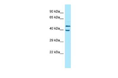 Western Blot: KIR2DL5/CD158f Antibody [NBP2-82265]