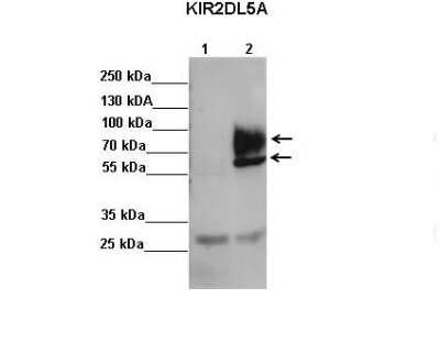 Western Blot: KIR2DL5/CD158f Antibody [NBP2-82265]