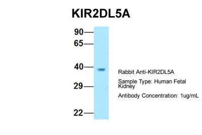 Western Blot: KIR2DL5/CD158f Antibody [NBP2-82265]