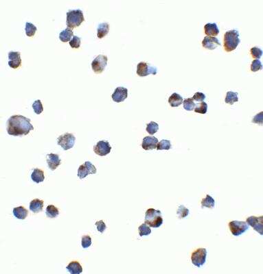 Immunocytochemistry/ Immunofluorescence: KIR2DS2 Antibody - BSA Free [NBP2-82102]